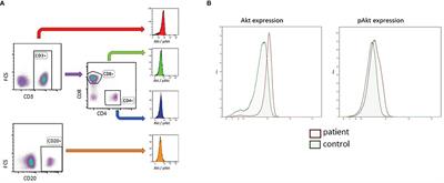 AKT Hyperphosphorylation and T Cell Exhaustion in Down Syndrome